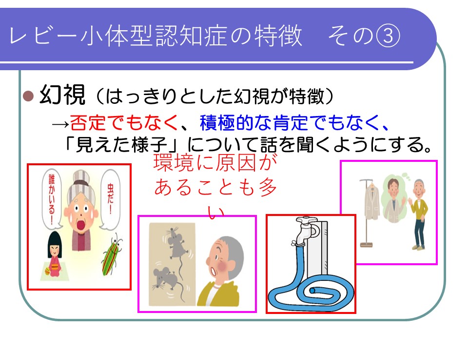 レビー小体型認知症3.幻視の特徴の画像